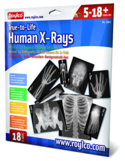 True To Life Human X-Rays?