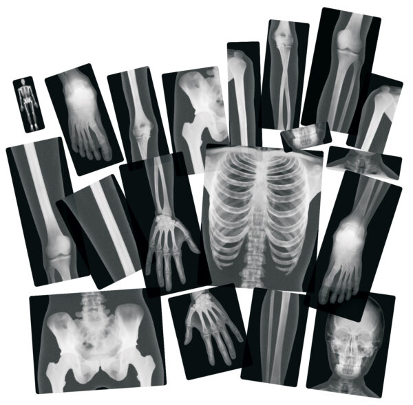 True To Life Human X-Rays - Image 3