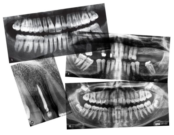 Dental X-Rays - Image 2